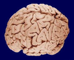 2008-02-15-Brain_090407.jpg