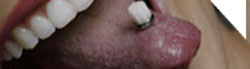 2008-02-22-fronttongue.jpg