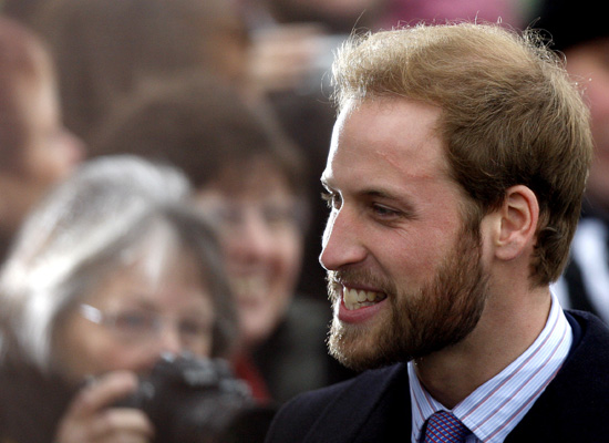 is prince william balding. on whether Prince William