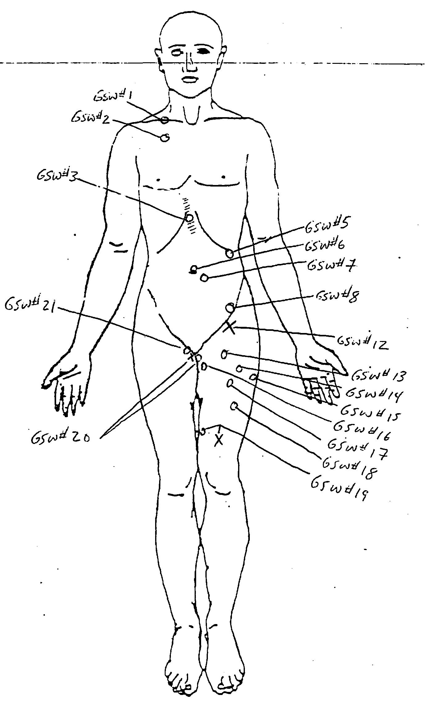 2010-03-13-Autopsy_p11.jpg