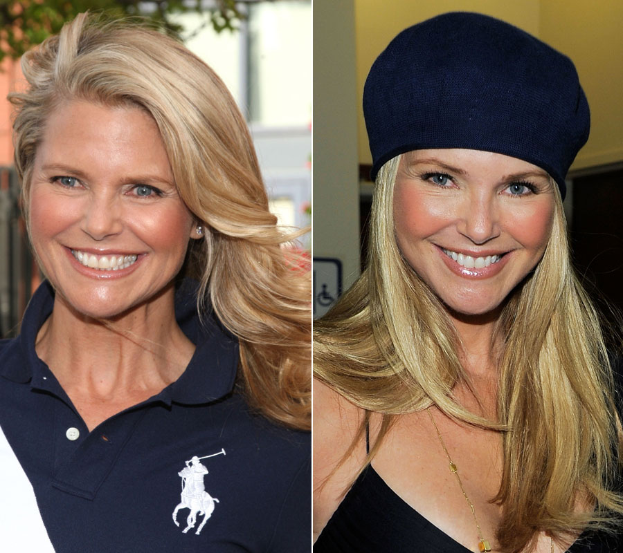 Christie Brinkley Face Lift Before After Photos Pictures Poll Huffpost