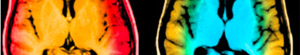 2010-11-29-brain.jpg