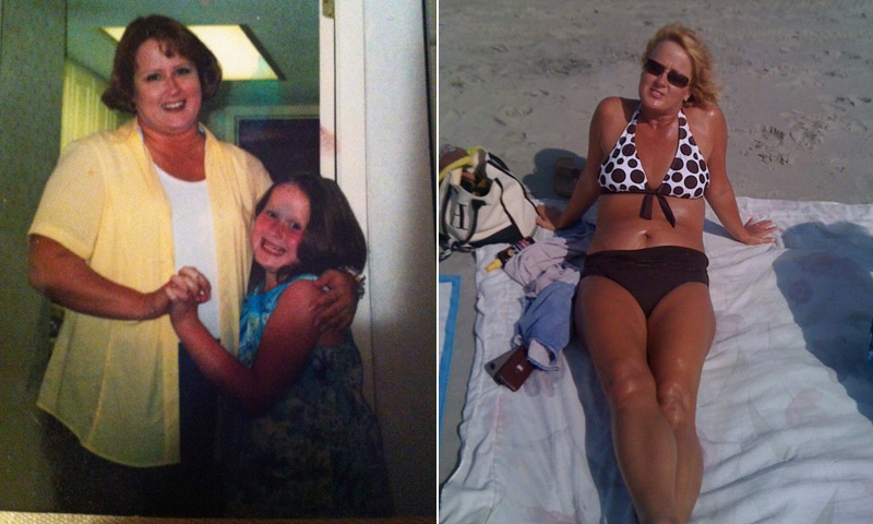 before and after weight loss pictures 100 pounds