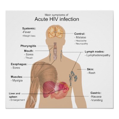 What are early symptoms of HIV?
