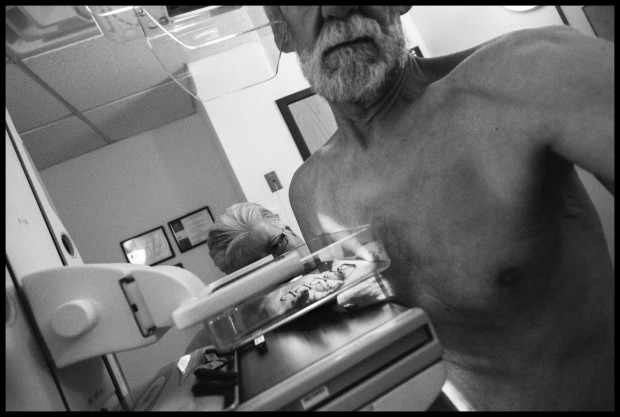 My Right Breast: A Man Facing a Breast Lump and Mammogram