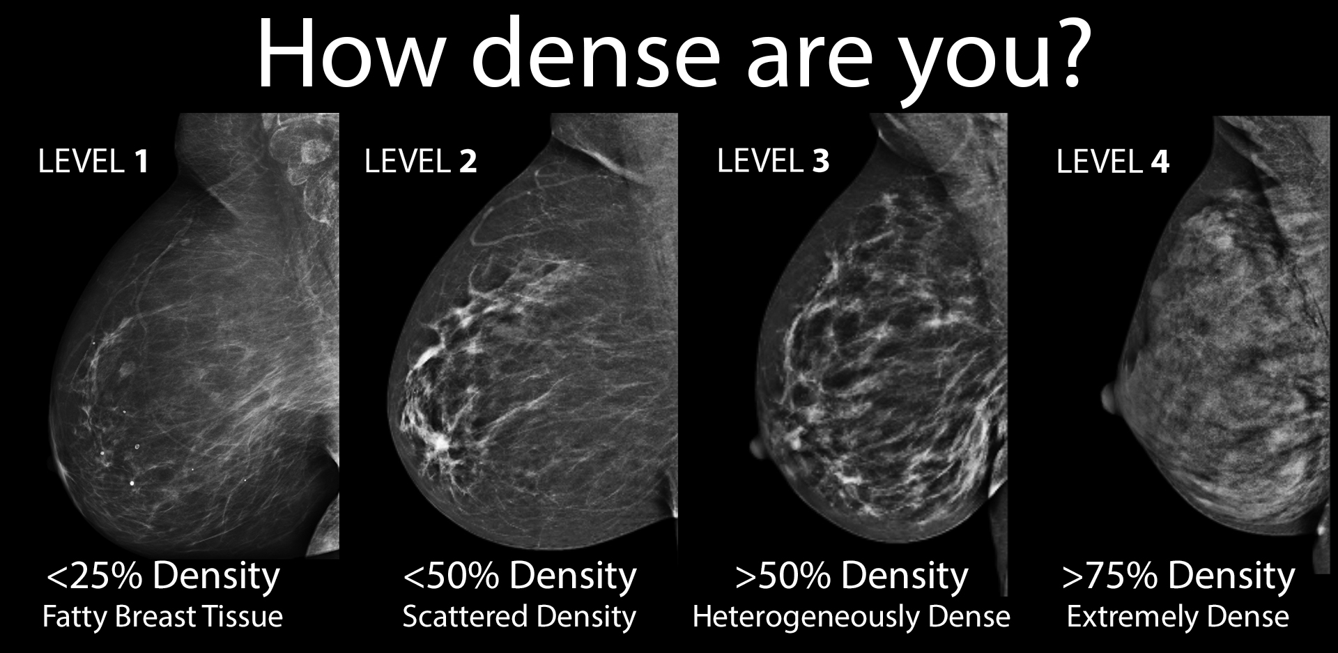 Breast Density Chart