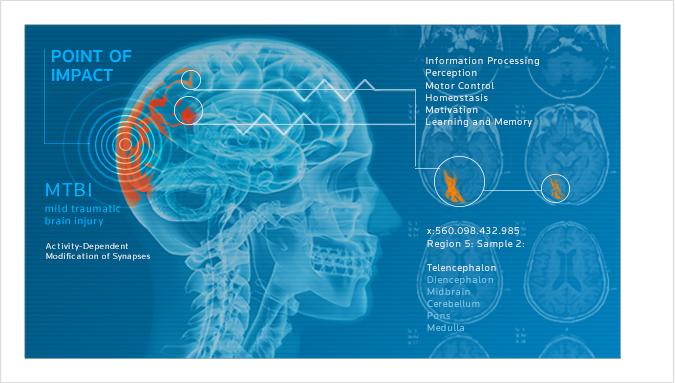 Research papers on brain injury