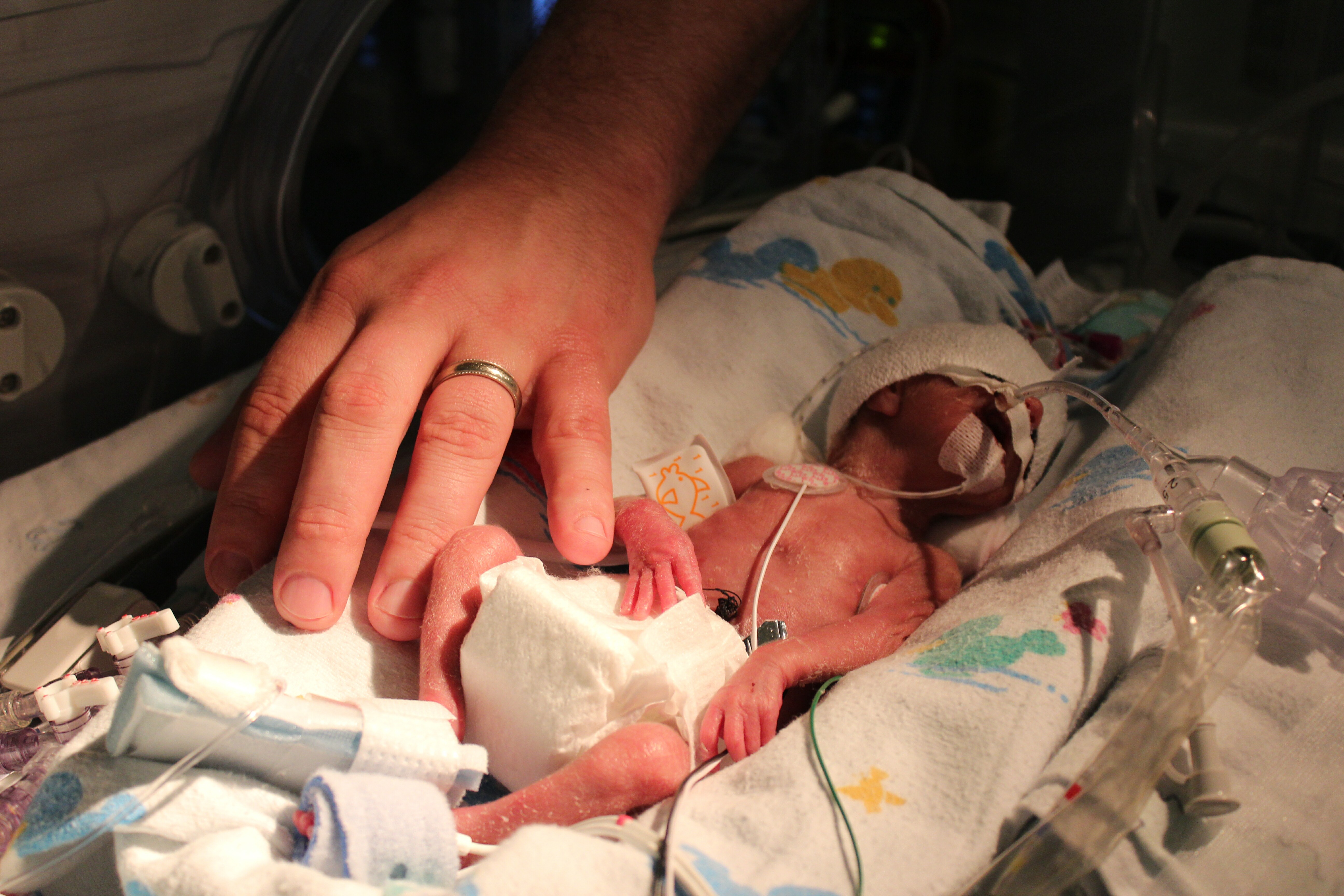 What Is A Micro Preemie Baby