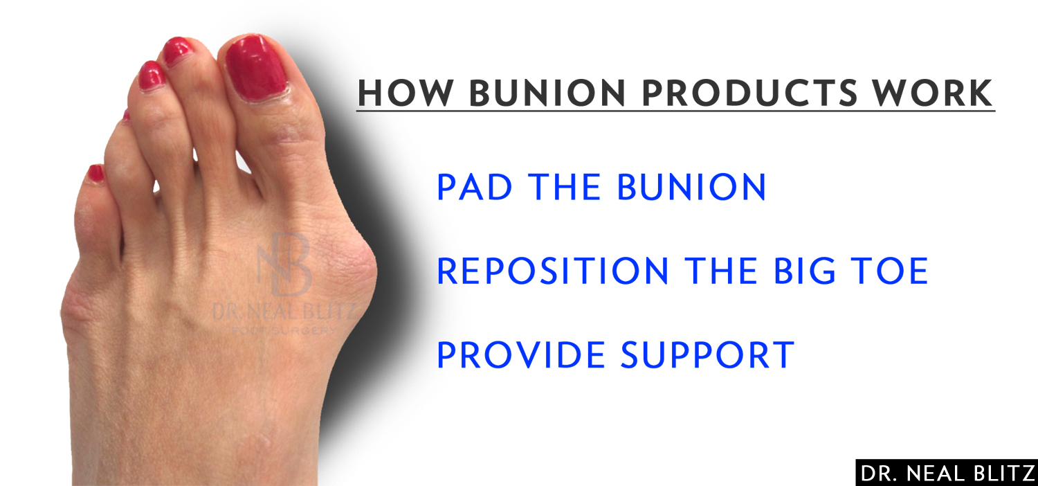 Products to Avoid Bunion Surgery 