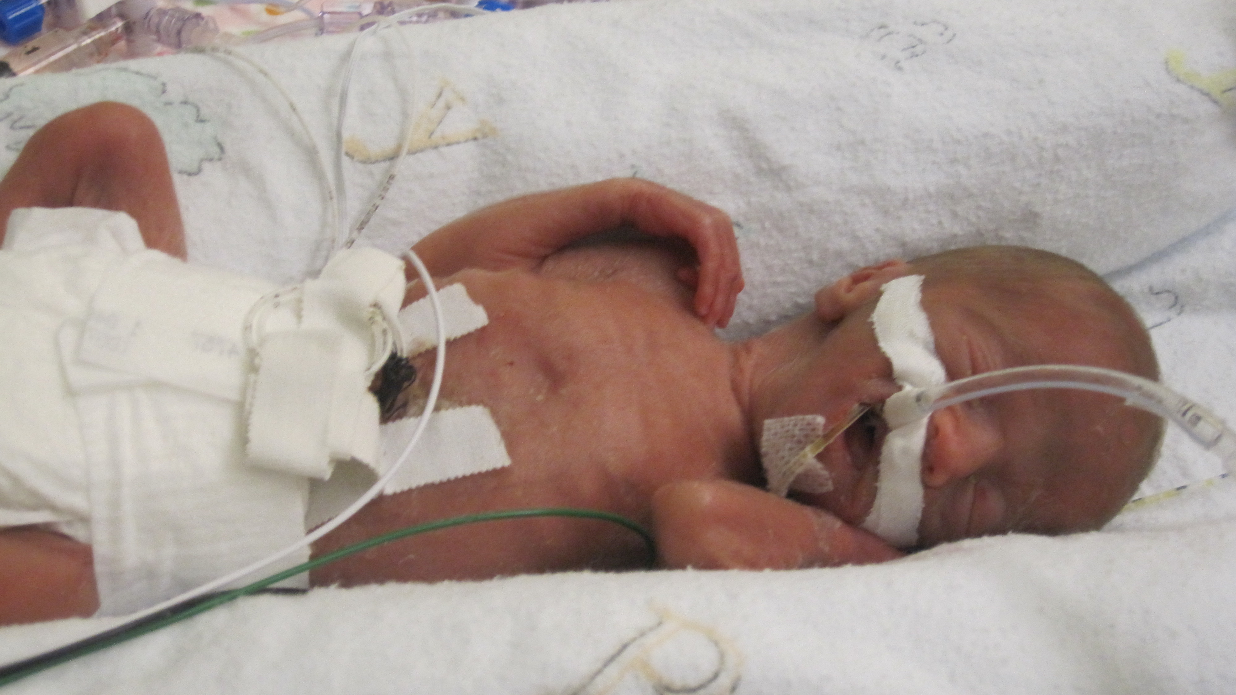 An Open Letter to Preemie Parents From a Micro Preemie Mom | HuffPost Life4000 x 2248