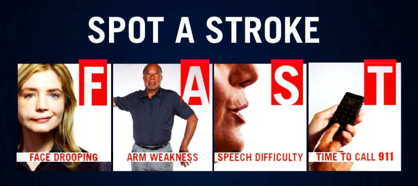 Kết quả hình ảnh cho spot a stroke fast
