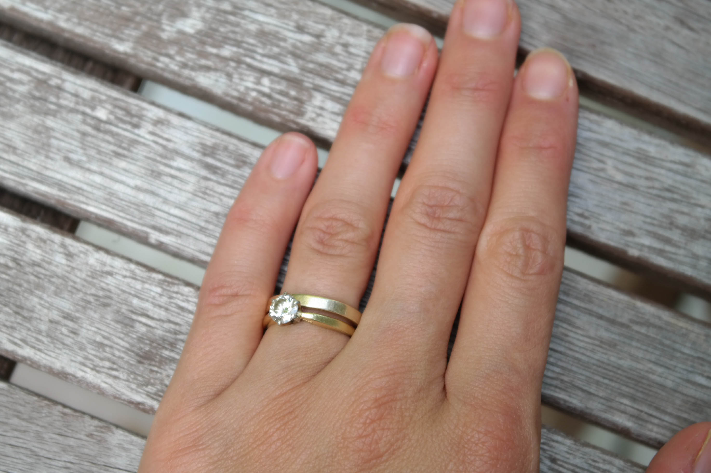 Wedding ring turns my finger black
