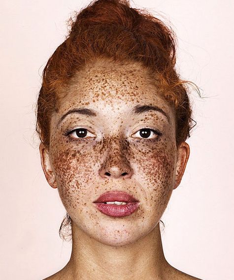 Breathtaking Photos Show The Undeniable Beauty Of Freckles Huffpost 