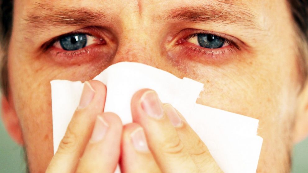 do-i-have-allergies-or-is-it-a-cold-huffpost