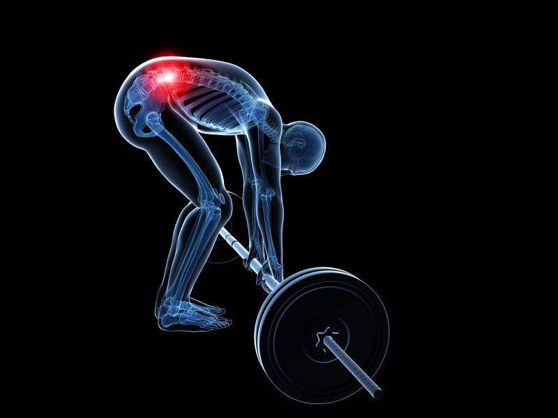 The 3 Most Common Strength Training Injuries HuffPost The 3 Most Common Strength Training Injuries HuffPost