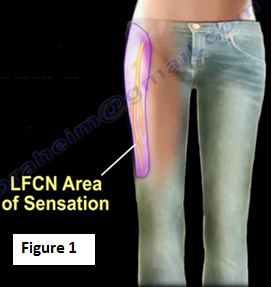Jeggings And Tight Jeans Can Cause Meralgia Paresthetica