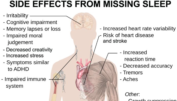 Deprivation ambien sleep stages of