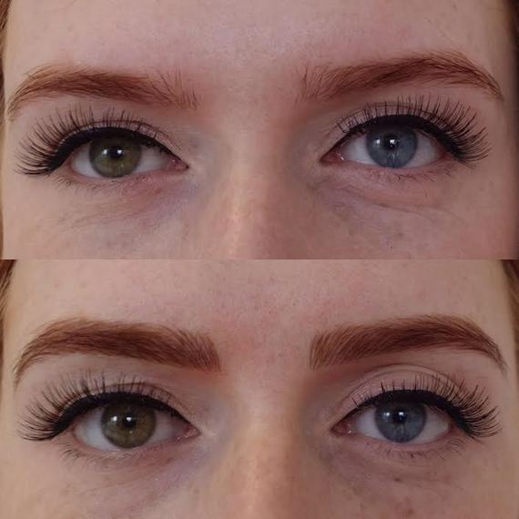 2016-09-19-1474292068-1861694-MicrobladingBeforeAfter.jpg