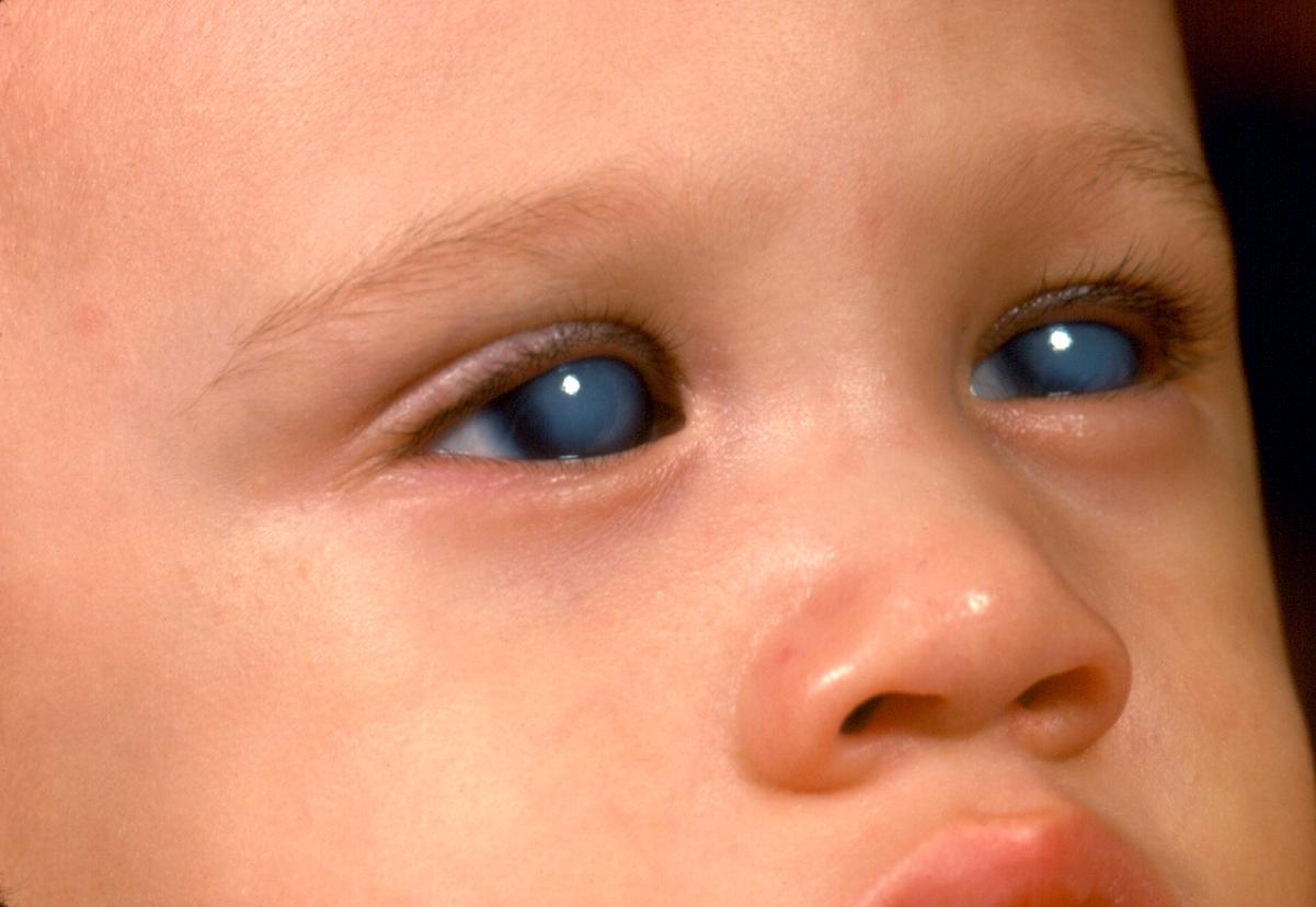 المياه الزرقاء "السوداء" في العين | سمير الجيزاوي