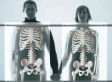 Fear, Greed and X-Rays