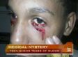 Doctors Believe They've Diagnosed Illness Of Boy Who Cries Tears Of Blood (VIDEO)