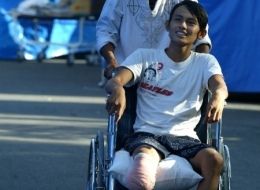Earthquake Amputee
