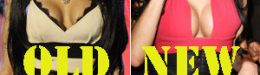 Amy Winehouse's Boob Job: Singer Debuts Her New Breasts (PHOTOS)