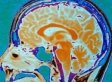 Rom Houben, Man In Coma For 23 Years, Was Fully Conscious, Mom Says