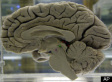 NFL Brain Study: League To Ask Players To Donate Brains