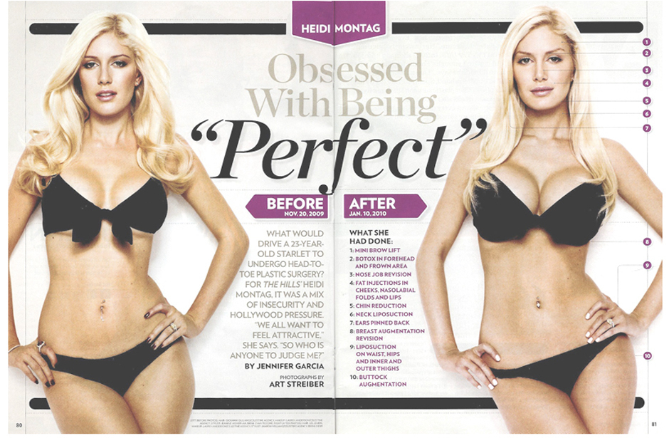 heidi montag before and after 10. I was an ugly duckling efore.