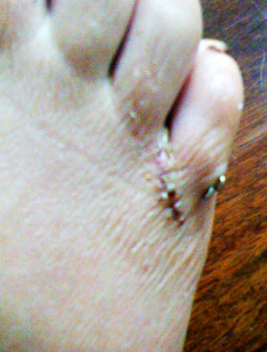 2010-09-19-wrinkly_foot.jpg