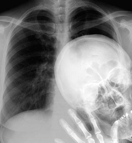 2010-11-29-xrayphtobomb.jpg