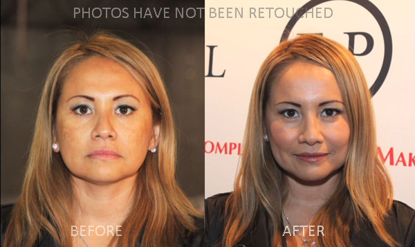 2011-07-06-Medium_beforeafter.JPG