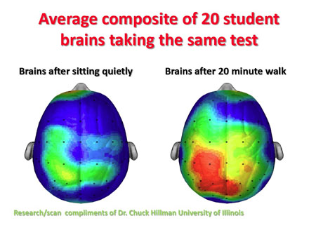 2011-07-11-BrainImages.jpg