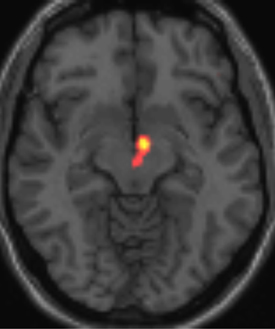 2012-02-14-BRAINnew.jpg