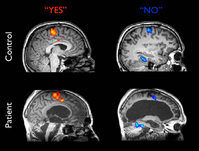 2012-08-01-brainscanimages.jpg