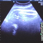 2012-09-05-Ultrasound.jpg