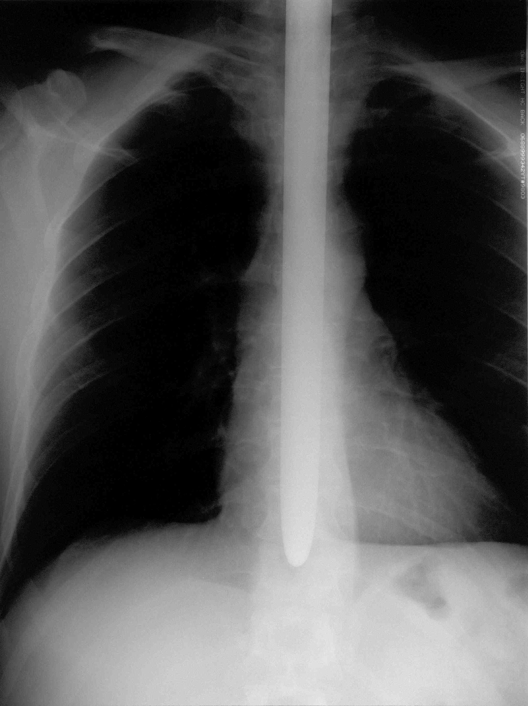 2012-09-12-Xray_DanMeyer.jpg