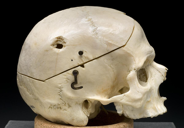 2013-01-30-Gunshot_skull.jpg