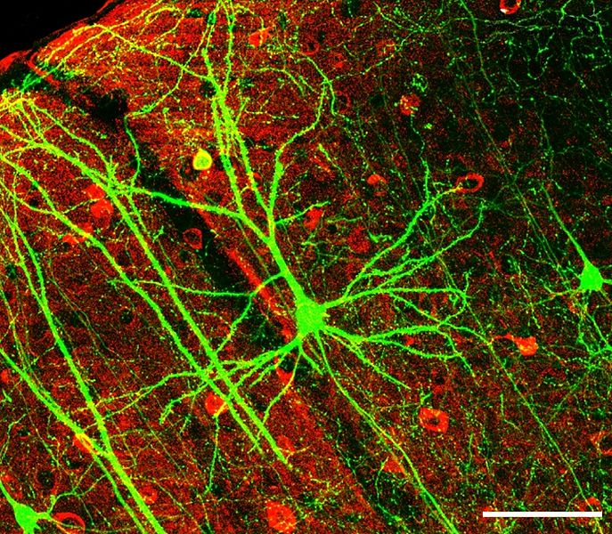 2013-02-28-687pxPLoSBiol4.e126.Fig6fNeuron.jpg