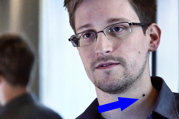 Obama Implores Snowden S Neck Mole To Become Nsa Mole Huffpost Multiple moles on the neck are usually called as skin tags or acrochordons. obama implores snowden s neck mole to