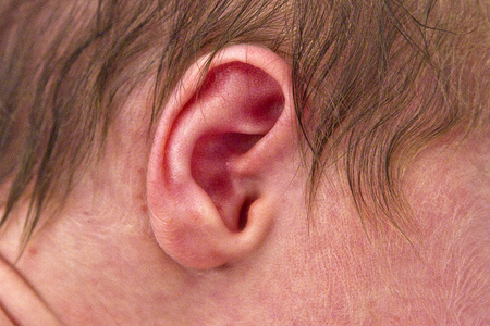 2013-07-16-ear.jpg