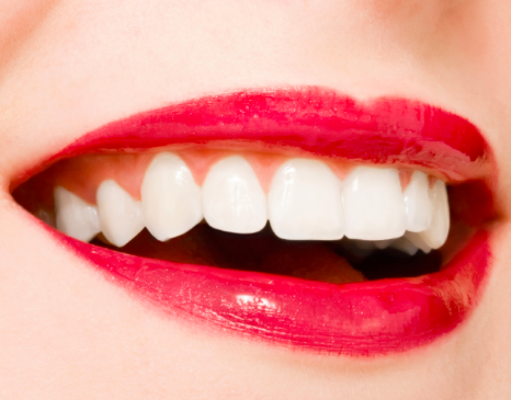 2013-11-11-Teeth1.png