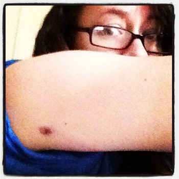 2014-02-10-bruise.jpg