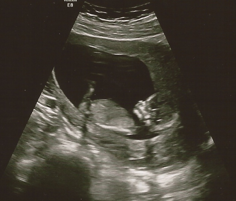 2014-04-22-ultrasound.jpeg