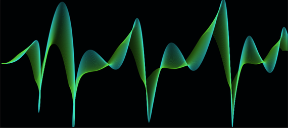 2014-06-01-Cardiograph.png