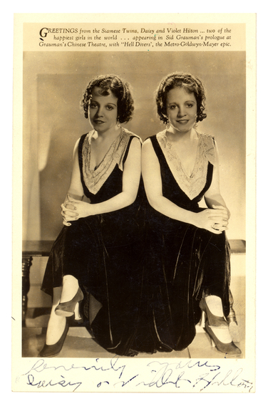 violet and daisy hilton