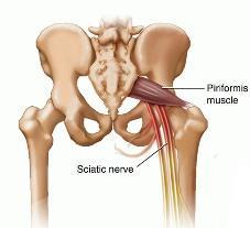 2014-07-23-piriformis.jpg