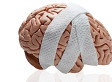 2014-08-04-sTRAUMATICBRAININJURYsmall.jpg