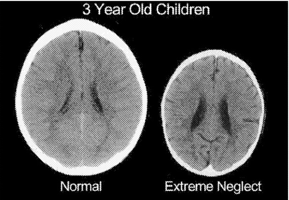 2014-09-29-childhoodtrauma.jpg